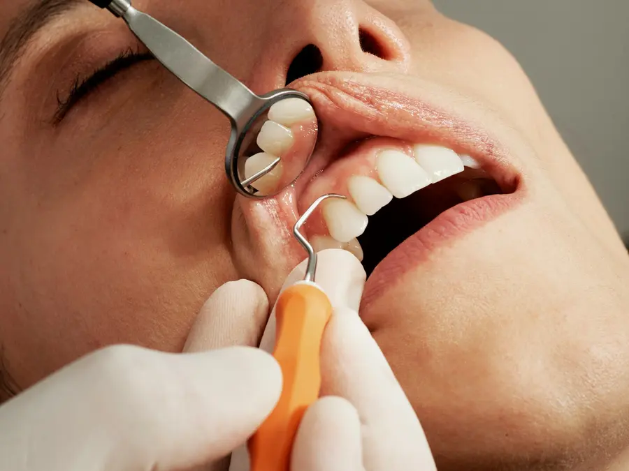 Dentist examining a patient teeth with a mirror and scaler