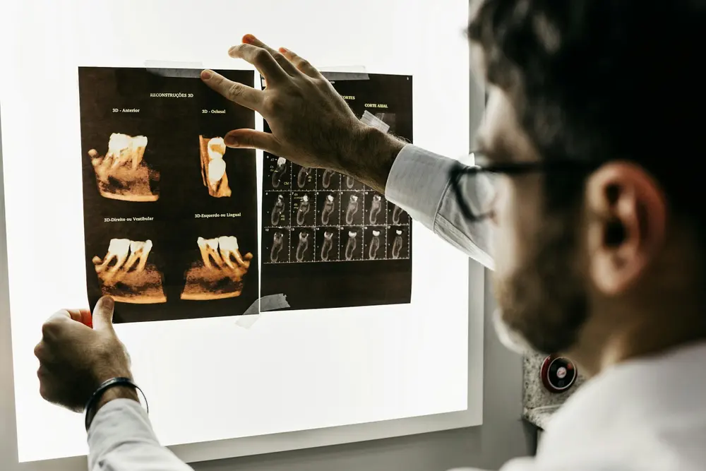 Dentist reviewing 3D scan images of teeth on a light box