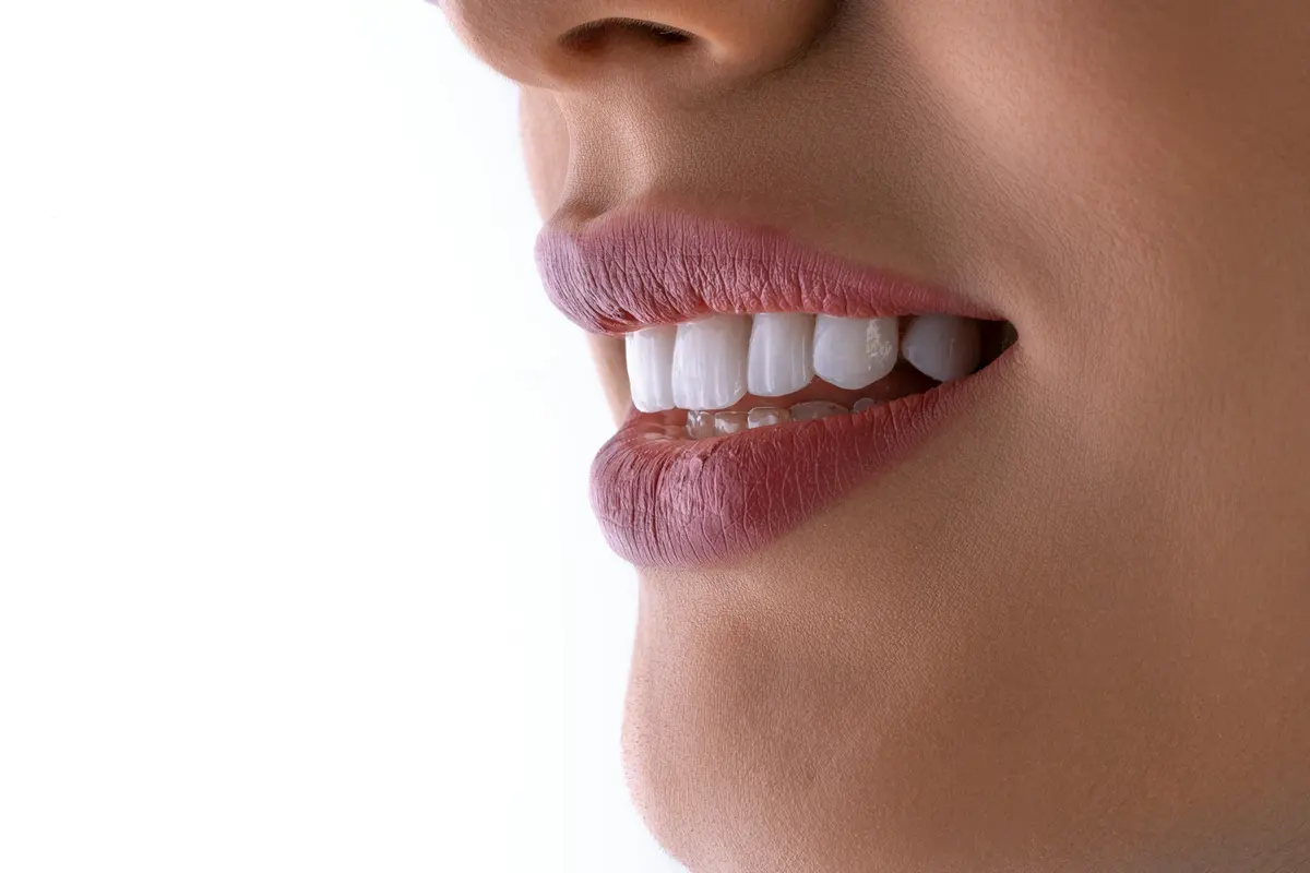 Close-up of a patient smiling with bright, even teeth